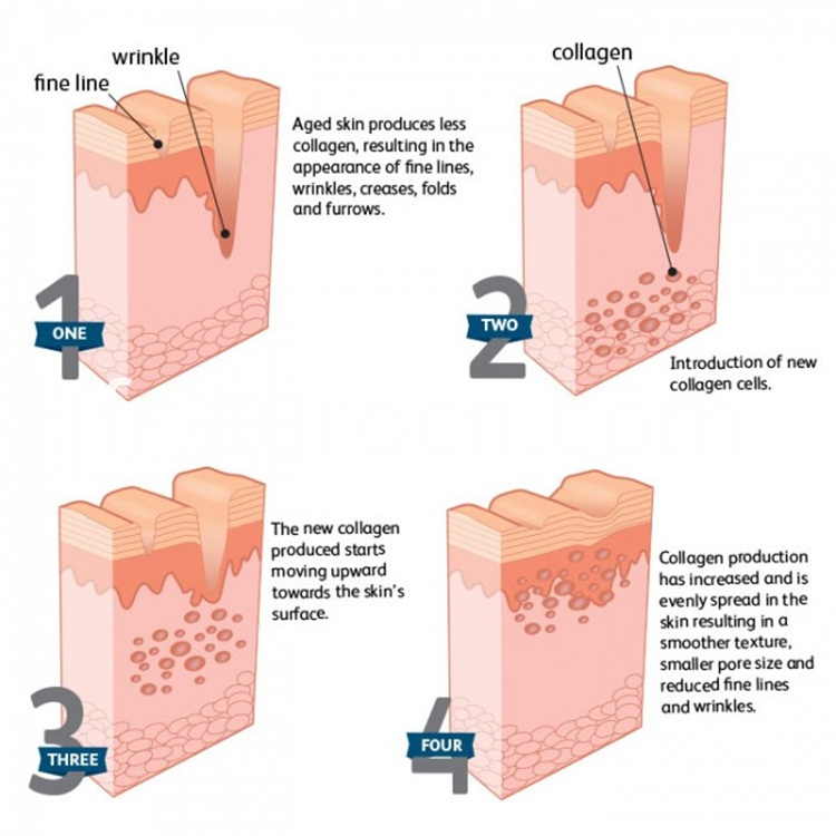 acide hyaluronique en vrac bulk hyaluronic acid